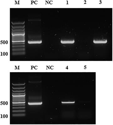 Transmission of a Protease-Secreting Bacterial Symbiont Among Pea Aphids via Host Plants